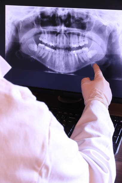Best Emergency Tooth Extraction  in Hydesville, CA